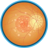Wet AMD